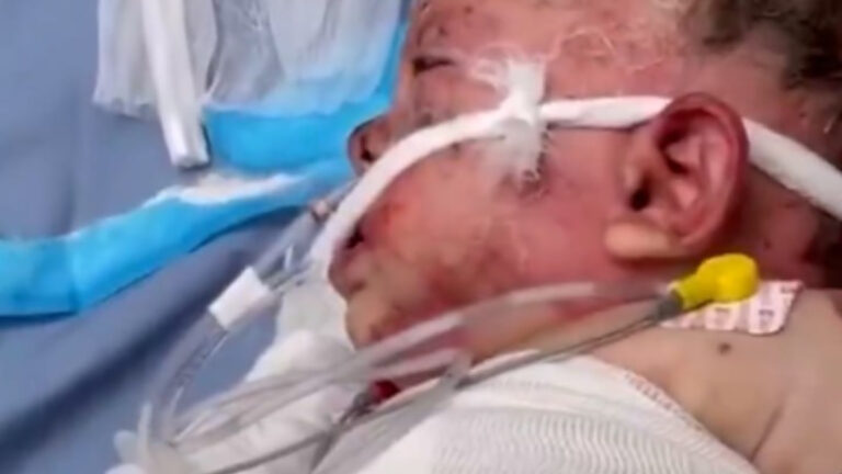 israil zulmunun utanc karesi gazzede 10 aylik bebek agir yaralandi IDD9nFFe